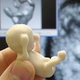 Illustration for article titled New Technology Prints 3-D Fetuses